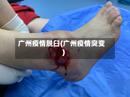 广州疫情脱臼(广州疫情突变)