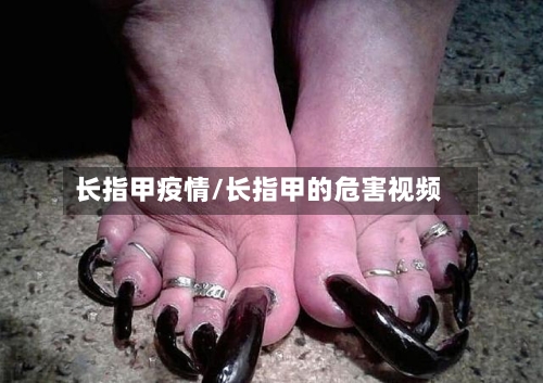 长指甲疫情/长指甲的危害视频