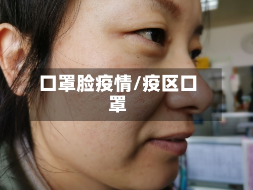 口罩脸疫情/疫区口罩-第2张图片